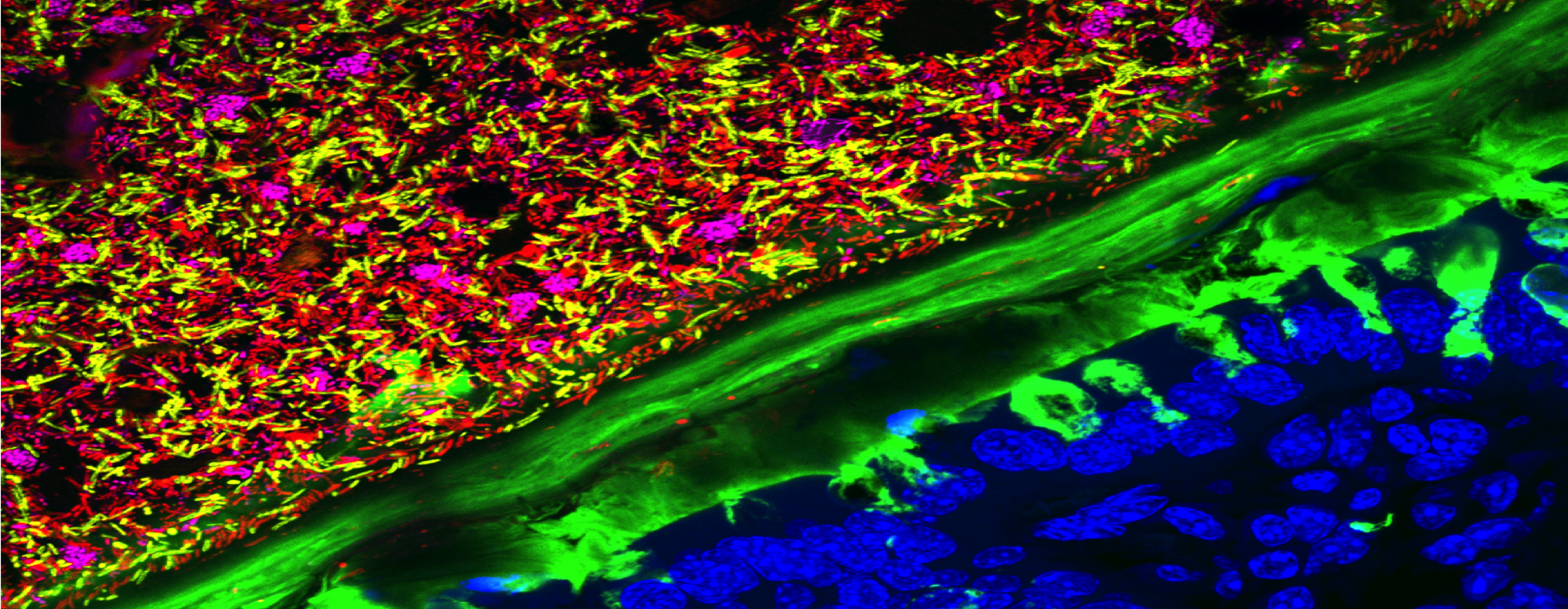 Image Credit: Gabe Billings and Kristen Earle